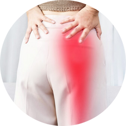 Sciatica