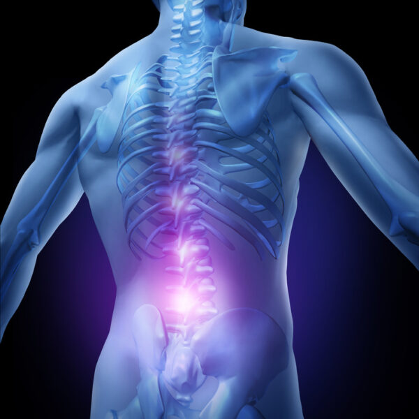 Spinal Decompression & Posture Correction